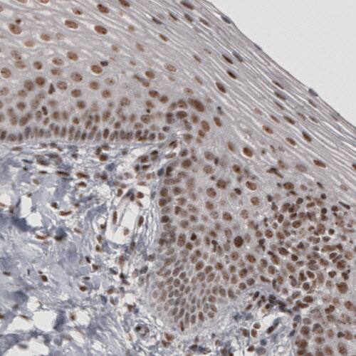 Staining of human cervix shows moderate nuclear immunoreactivity in epithelial and underlying connective tissue cells.