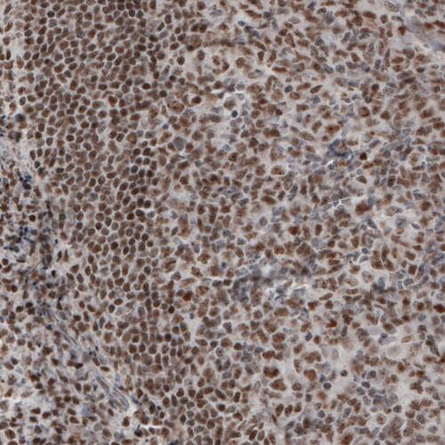 Staining of human tonsil shows nuclear immunoreactivity in lymphoid cells.