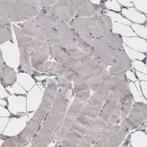 Staining of human skeletal muscle shows absence of immunoreactivity (negative control).
