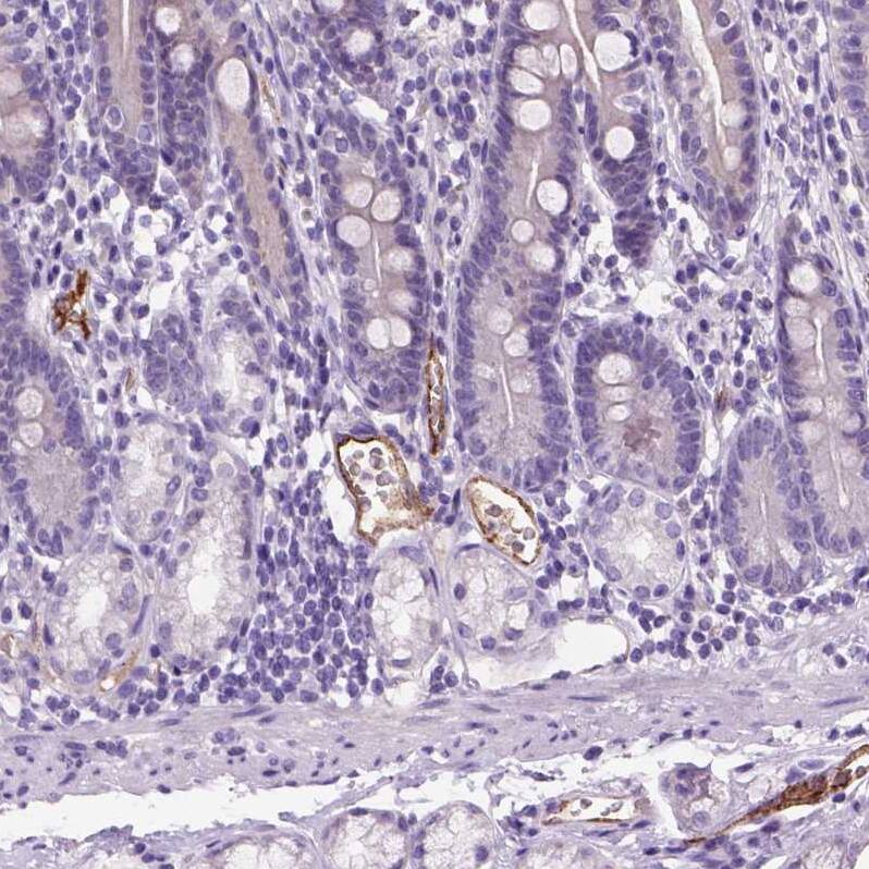 Staining of human duodenum shows moderate cytoplasmic positivity in endothelial cells.