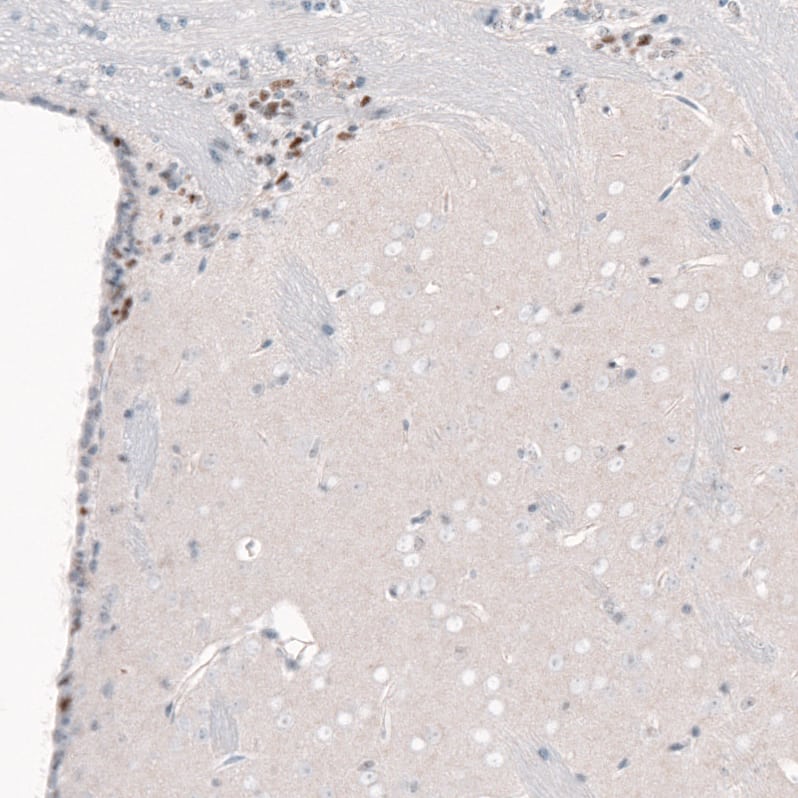 Staining of mouse forebrain shows nuclear positivity in a subset of cells in the lateral ventricle wall.