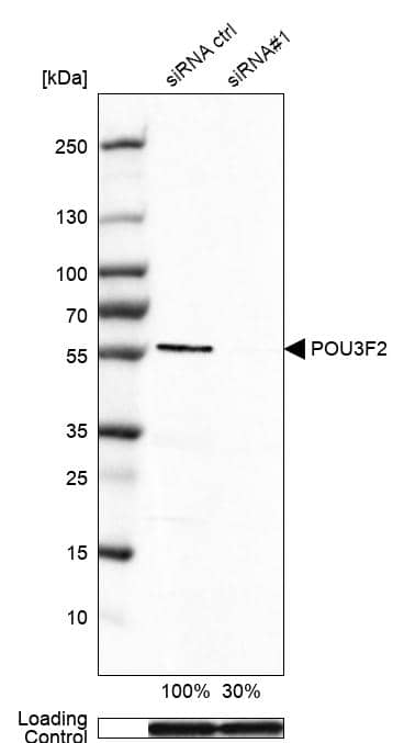Analysis in HEK293 cells transfected with control siRNA, target specific siRNA probe #1, using Anti-POU3F2/OCT7 antibody. Remaining relative intensity is presented. Loading control: Anti-GAPDH.