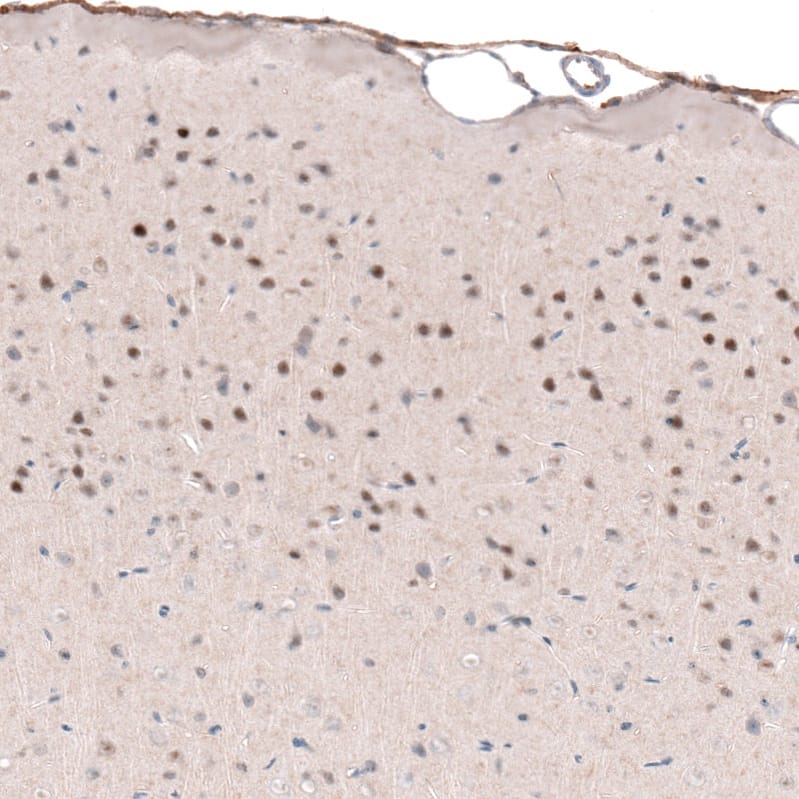 Staining of mouse brain shows  moderate nuclear positivity in neurons in cortical layers 2-4.