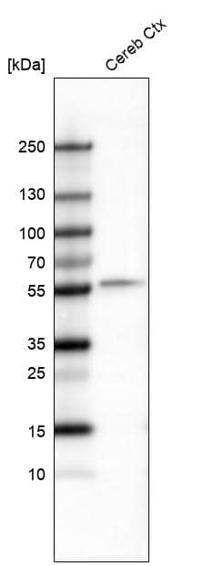 Analysis in mouse cerebral cortex tissue.