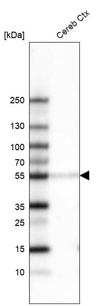 Analysis in human cerebral cortex tissue.