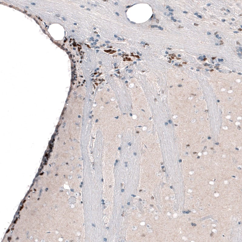 Staining of mouse brain shows strong nuclear positivity in neurons in the lateral ventricle wall.