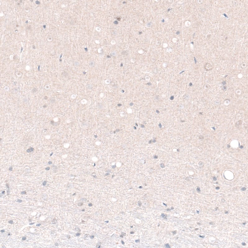 Staining of rat cerebral cortex shows no nuclear positivity in neurons in layer 6 as expected.