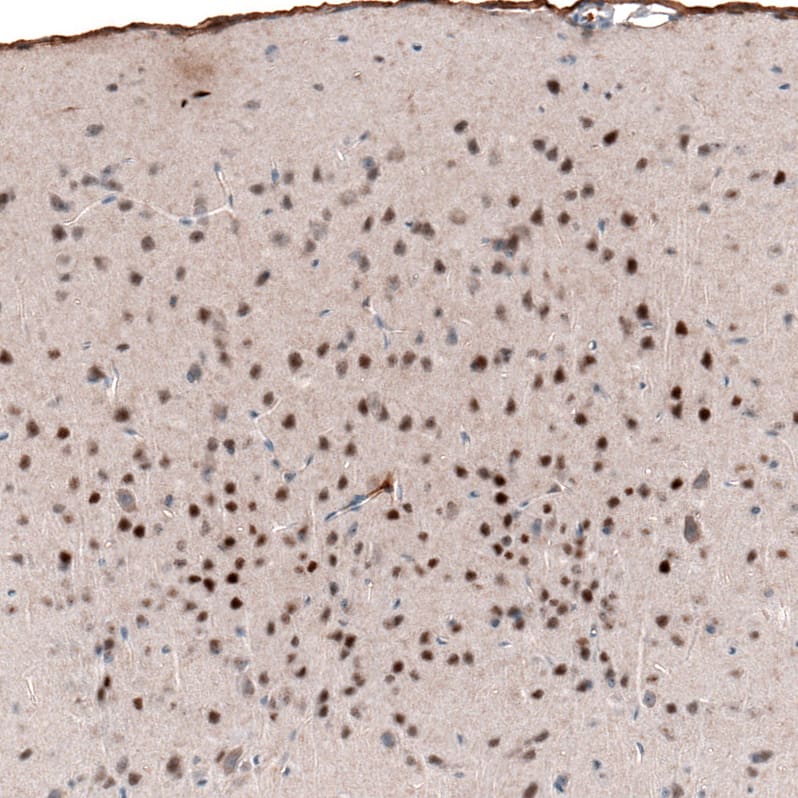 Staining of mouse cerebral cortex shows strong nuclear positivity in neurons in layers 2-4.