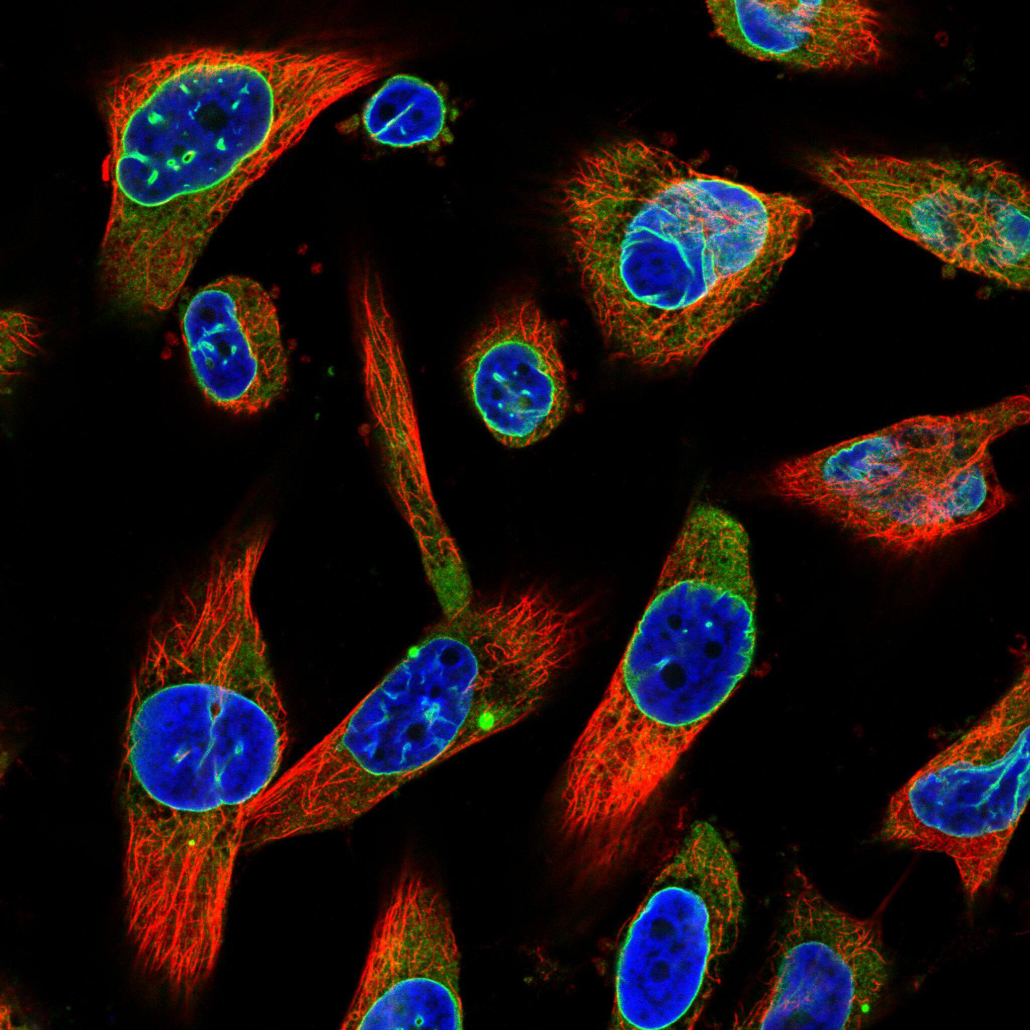 Staining in U251 cell line with Anti-Emerin monoclonal antibody) .