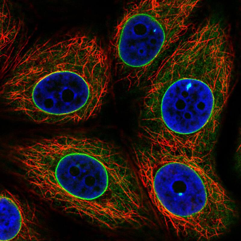 Staining in MCF7 cell line with Anti-Emerin monoclonal antibody) .