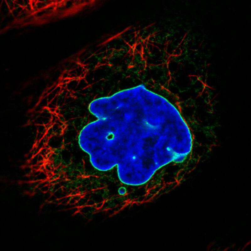 Staining in A431 cell line with Anti-Emerin monoclonal antibody) .