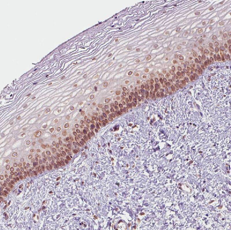 Staining of human uterine cervix shows moderate nuclear membrane positivity in squamous epithelial cells.