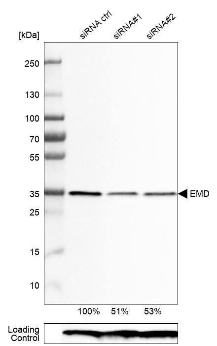 Analysis in RT-4 cells transfected with control siRNA, target specific siRNA probe #1 and #2, using Anti-Emerin antibody. Remaining relative intensity is presented. Loading control: Anti-PPIB.