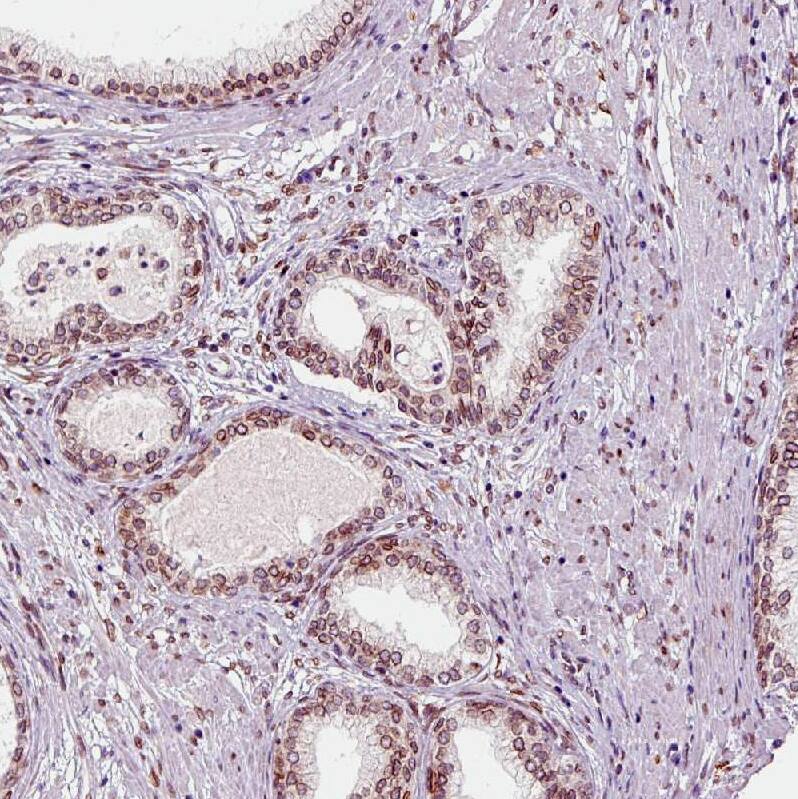 Staining of human prostate shows moderate nuclear membrane positivity in  in glandular cells.