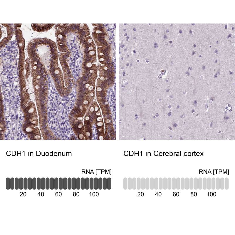 Analysis in human duodenum and cerebral cortex tissues using NBP3-43887 antibody. Corresponding E-Cadherin RNA-seq data are presented for the same tissues.