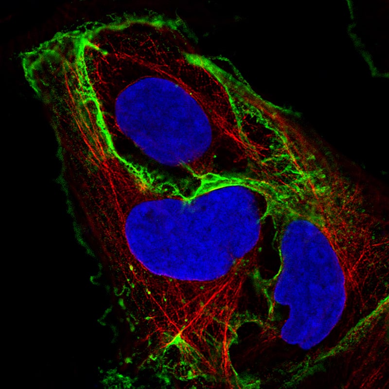 Staining of BEWO cells using the Anti-E-Cadherin monoclonal antibody) .