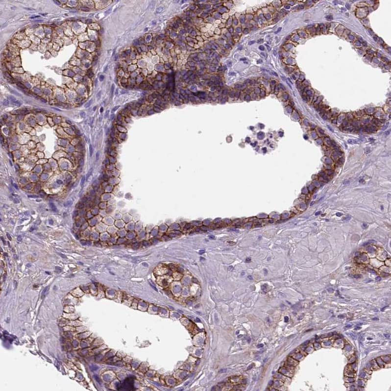 Staining of human prostate shows strong membranous positivity in glandular cells.