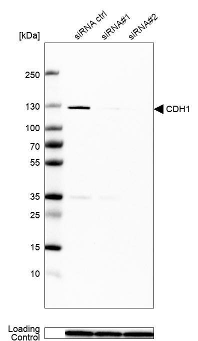 Analysis in MCF-7 cells transfected with control siRNA, target specific siRNA probe #1 and #2, using Anti-E-Cadherin antibody. Remaining relative intensity is presented. Loading control: Anti-GAPDH.