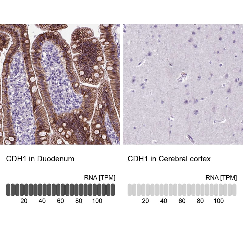 Analysis in human duodenum and cerebral cortex tissues using NBP3-43888 antibody. Corresponding E-Cadherin RNA-seq data are presented for the same tissues.