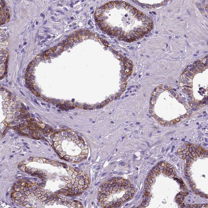 Staining of human prostate shows strong membranous positivity in glandular cells.