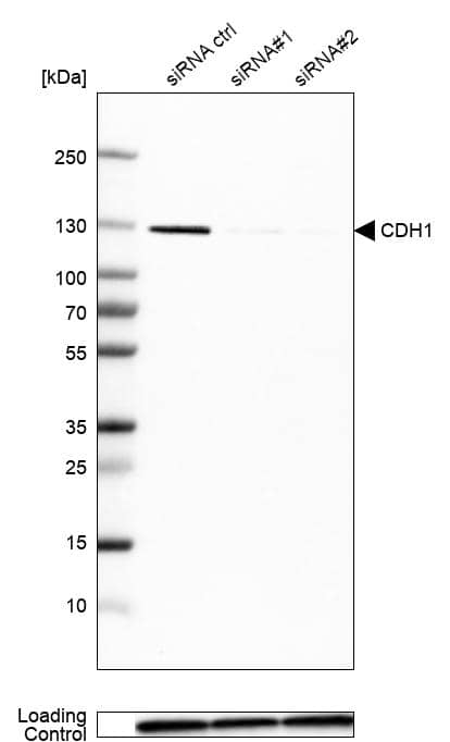 Analysis in MCF-7 cells transfected with control siRNA, target specific siRNA probe #1 and #2, using Anti-E-Cadherin antibody. Remaining relative intensity is presented. Loading control: Anti-GAPDH.