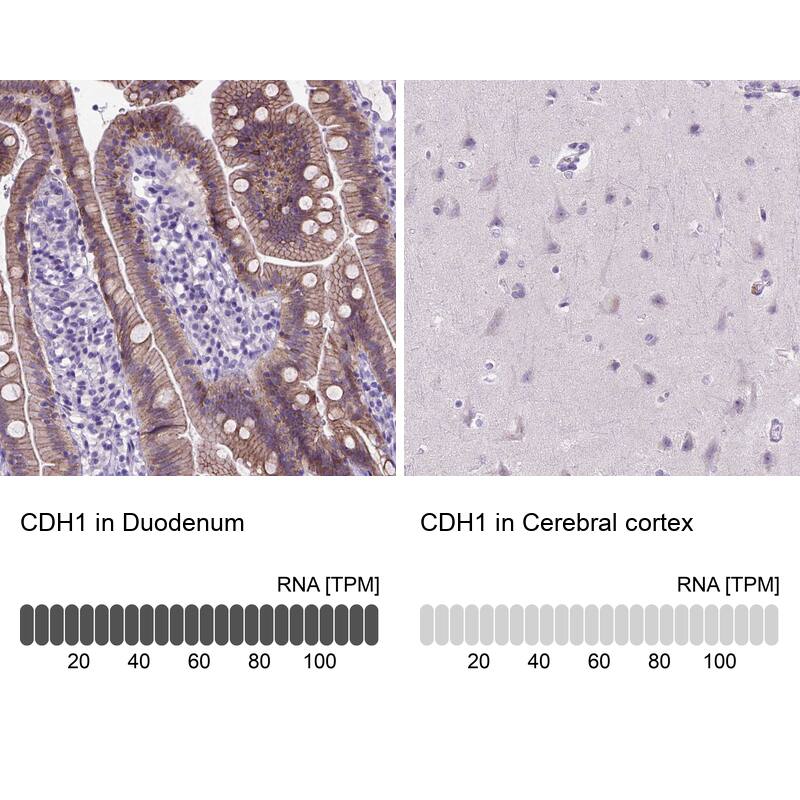 Analysis in human duodenum and cerebral cortex tissues using NBP3-43889 antibody. Corresponding E-Cadherin RNA-seq data are presented for the same tissues.