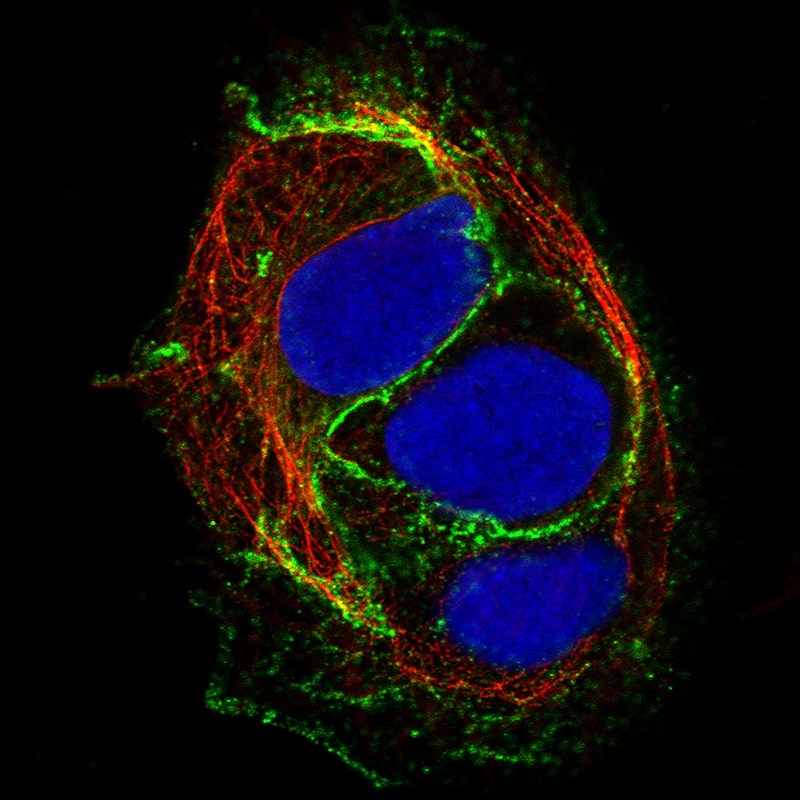 Staining of BEWO cells using the Anti-E-Cadherin monoclonal antibody) .
