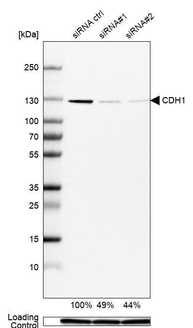 Analysis in MCF-7 cells transfected with control siRNA, target specific siRNA probe #1 and #2, using Anti-E-Cadherin antibody. Remaining relative intensity is presented. Loading control: Anti-GAPDH.