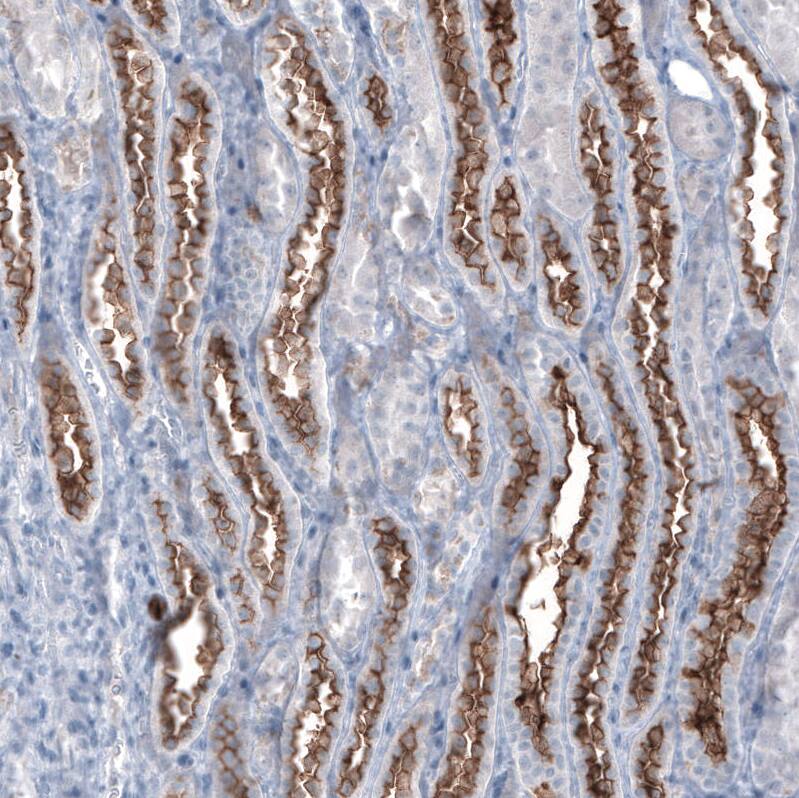 Staining of human kidney shows strong membranous positivity in cells in tubules.