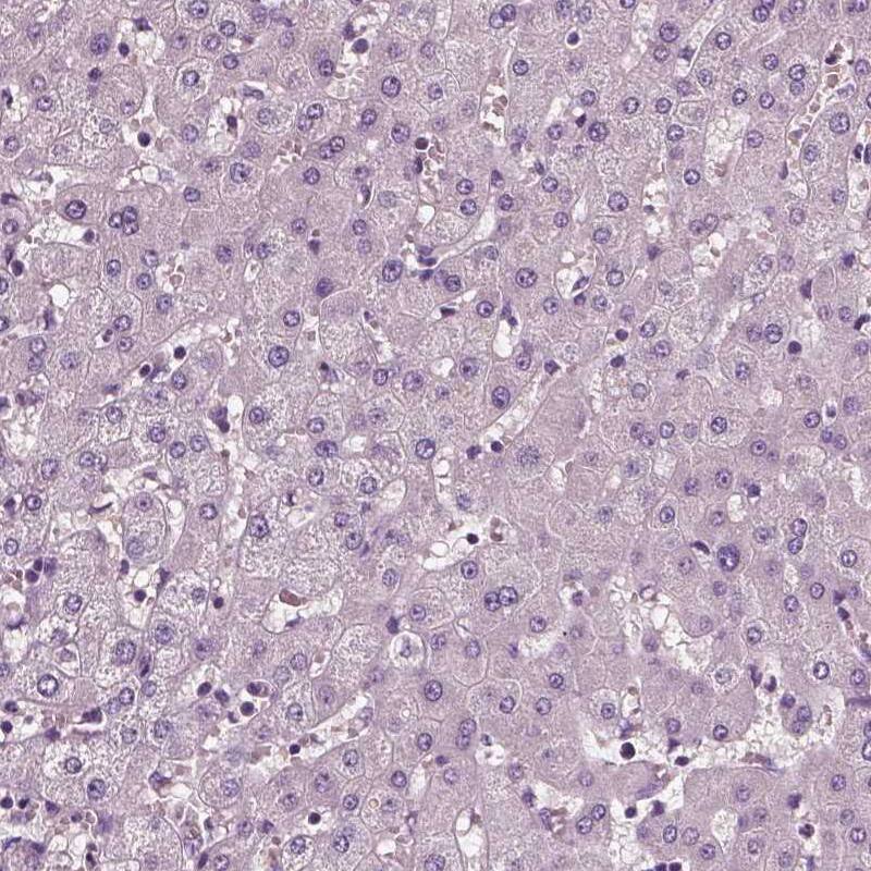 Staining of human liver shows no positivity as expected.