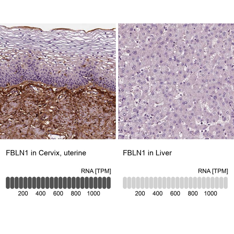 Analysis in human cervix, uterine and liver tissues using NBP3-43893 antibody. Corresponding Fibulin 1 RNA-seq data are presented for the same tissues.