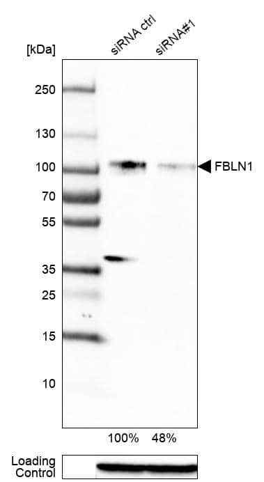 Analysis in RT-4 cells transfected with control siRNA, target specific siRNA probe #1, using Anti-Fibulin 1 antibody. Remaining relative intensity is presented. Loading control: Anti-GAPDH.