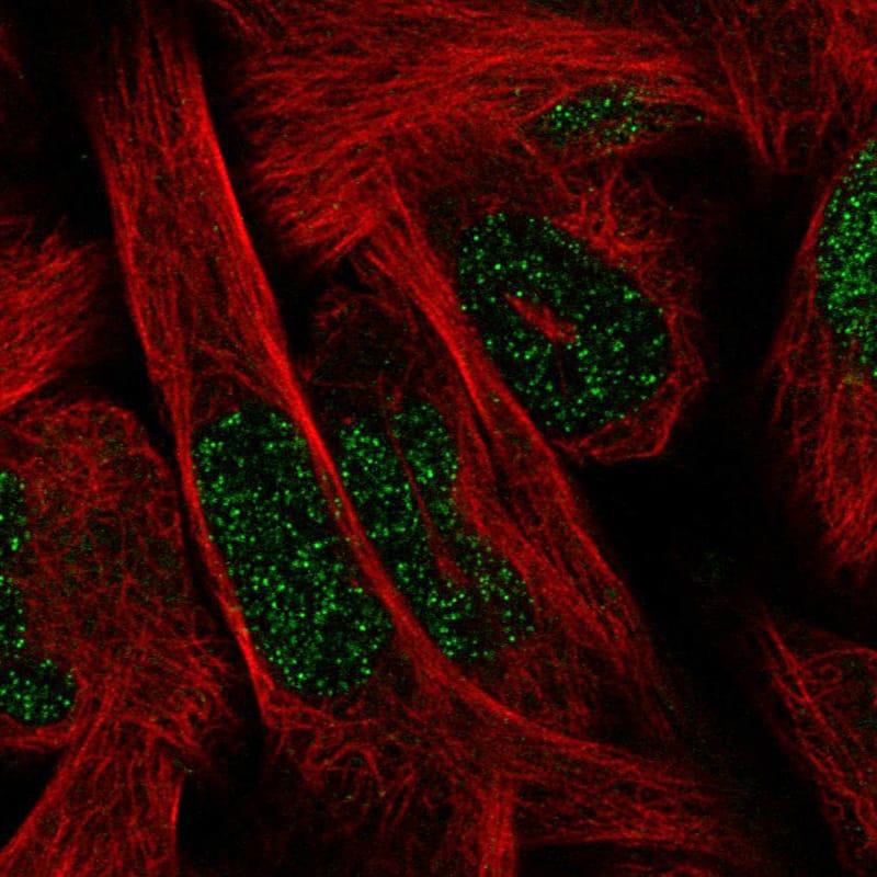 Staining in RH30 cell line with Anti-SIX1 monoclonal antibody) .