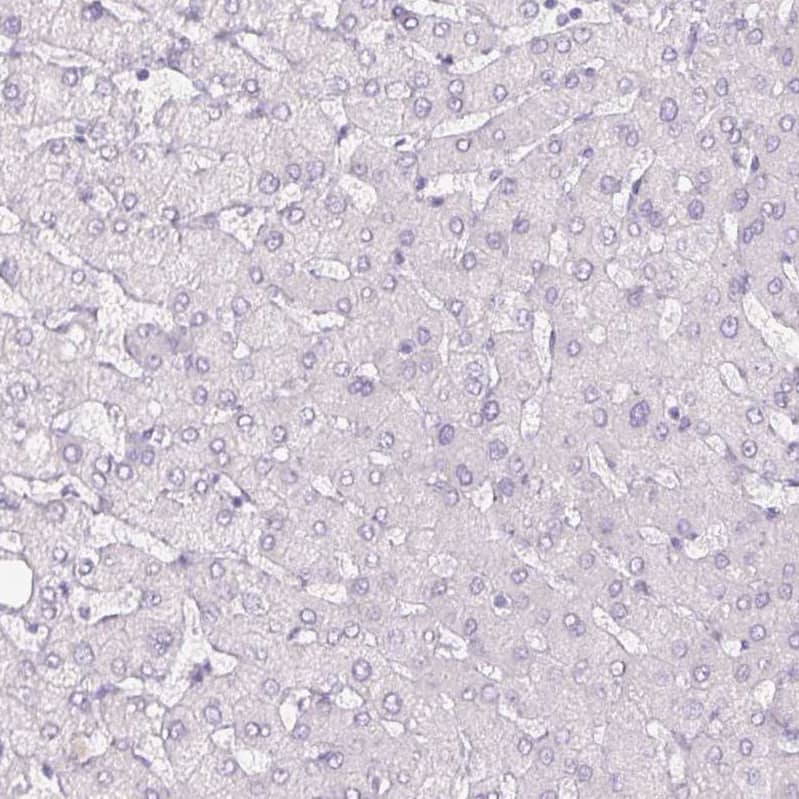 Staining of human liver shows no positivity in hepatocytes as expected.