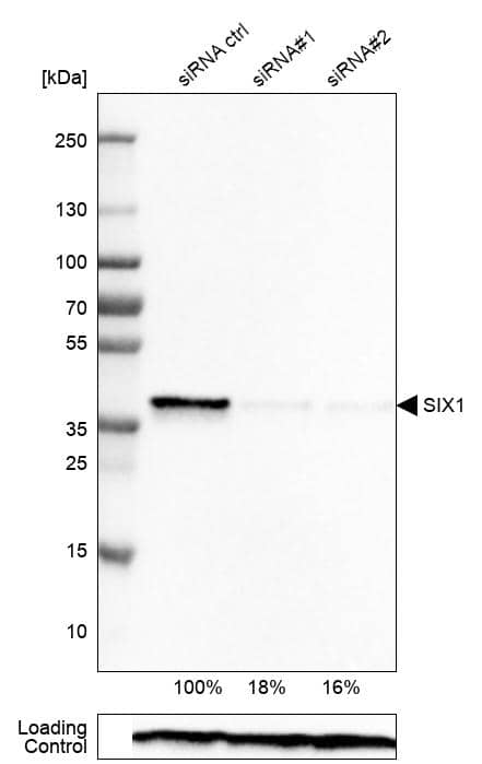Analysis in Rh30 cells transfected with control siRNA, target specific siRNA probe #1 and #2, using Anti-SIX1 antibody. Remaining relative intensity is presented. Loading control: Anti-PPIB.