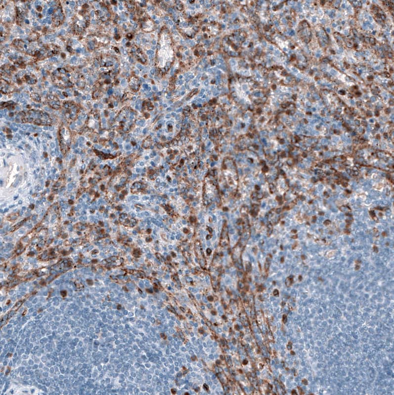 Staining of human spleen shows moderate positivity in cells in red pulp.