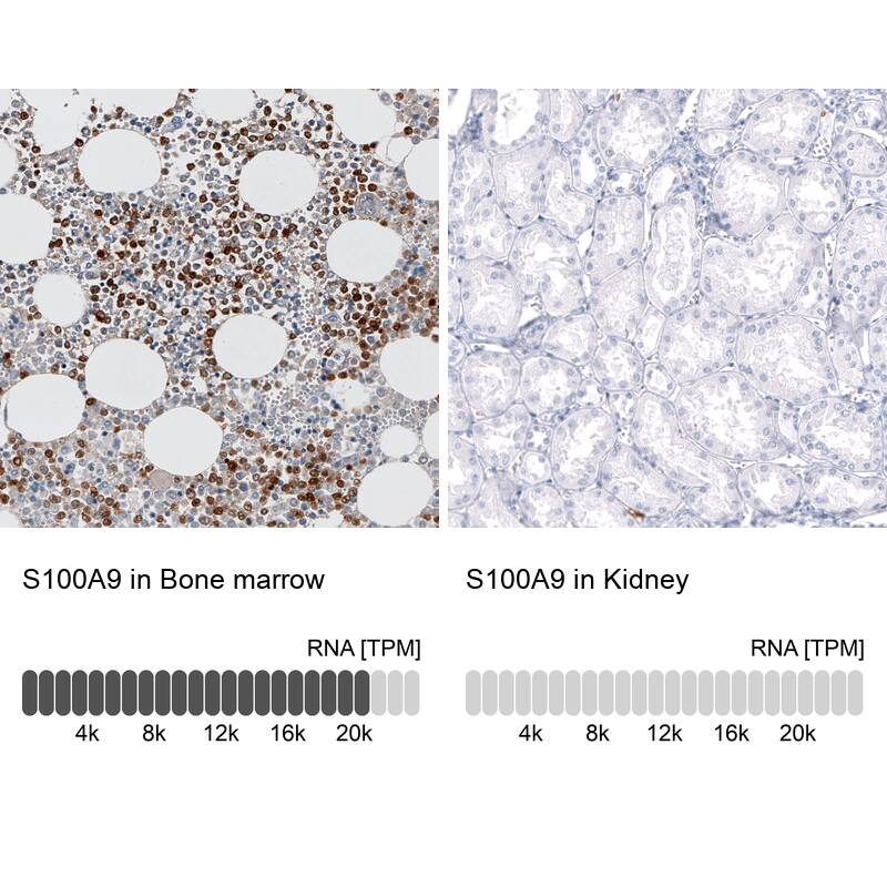Analysis in human bone marrow and kidney tissues using NBP3-43896 antibody. Corresponding S100A9 RNA-seq data are presented for the same tissues.