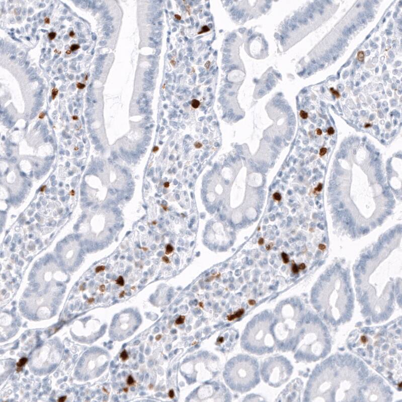 Staining of human small intestine shows strong cytoplasmic positivity in lymphoid cells.