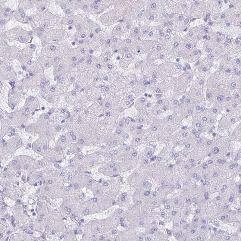 Staining of human liver shows no positivity in hepatocytes as expected.