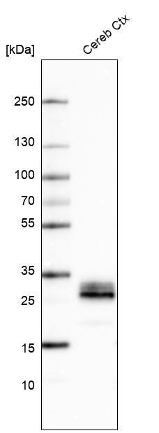 Analysis in human cerebral cortex tissue.