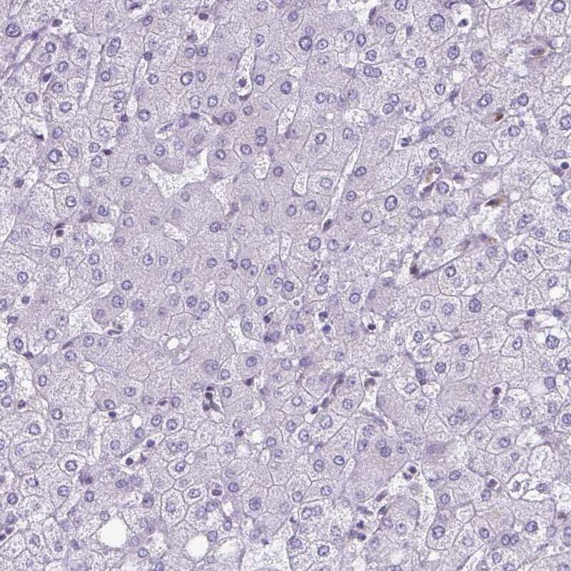 Staining of human liver shows no positivity in hepatocytes as expected.