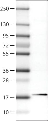 Lane 1: Marker [kDa]Lane 2: Human cell line RT-4