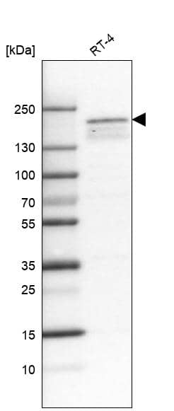 Analysis in human cell line RT-4.