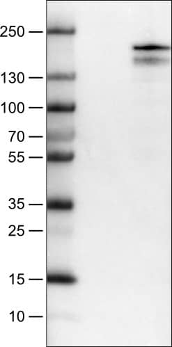 Lane 1: Marker [kDa]Lane 2: Negative control (vector only transfected HEK293T lysate) Lane 3: Lysine (K)-specific Demethylase 5B/KDM5B/JARID1B Over-expression Lysate (Co-expressed with a C-terminal myc-DDK tag (~3.1 kDa) in mammalian HEK293T cells) 