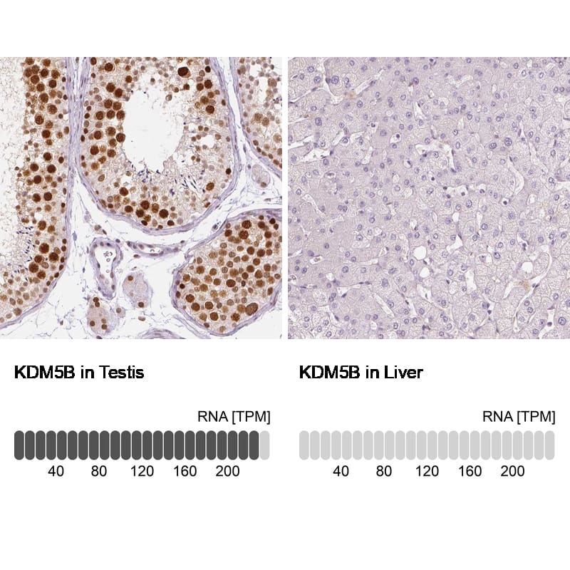 Analysis in human testis and liver tissues using NBP3-43901 antibody. Corresponding Lysine (K)-specific Demethylase 5B/KDM5B/JARID1B RNA-seq data are presented for the same tissues.