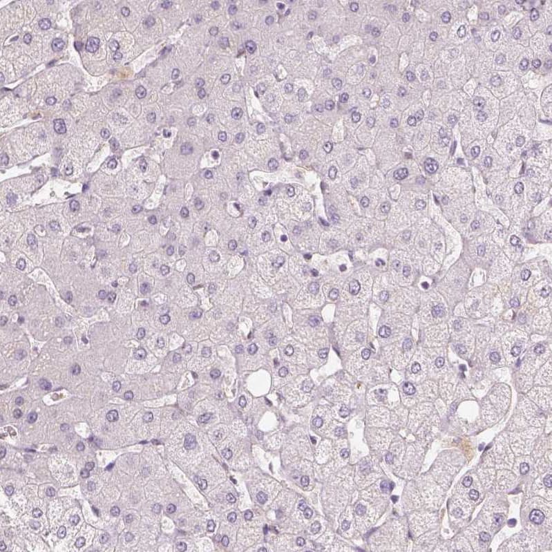 Staining of human liver shows no positivity in hepatocytes as expected.