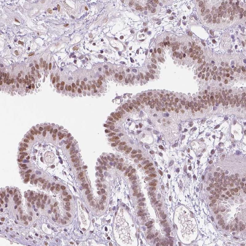 Staining of human fallopian tube shows moderate nuclear positivity in glandular cells.