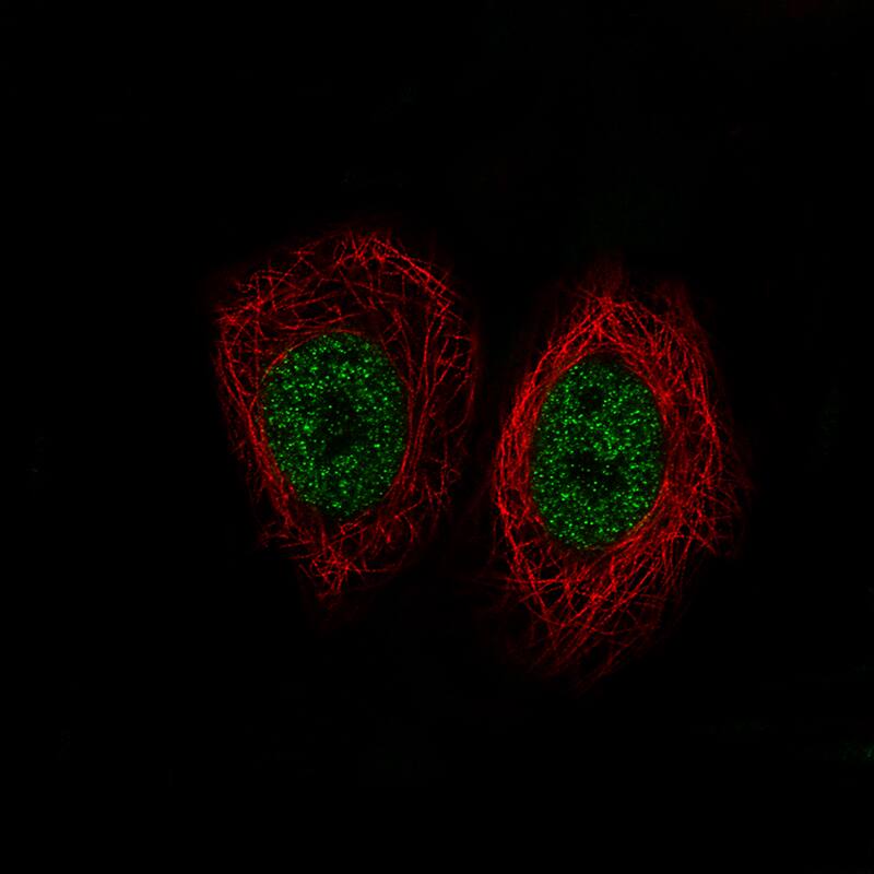 Staining of MCF7 cells using the Anti-Lysine (K)-specific Demethylase 5B/KDM5B/JARID1B monoclonal antibody) .