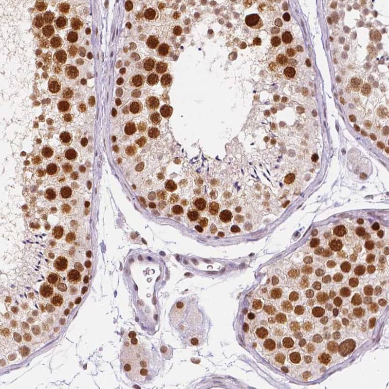 Staining of human testis shows strong nuclear positivity in cells in seminiferous ducts.