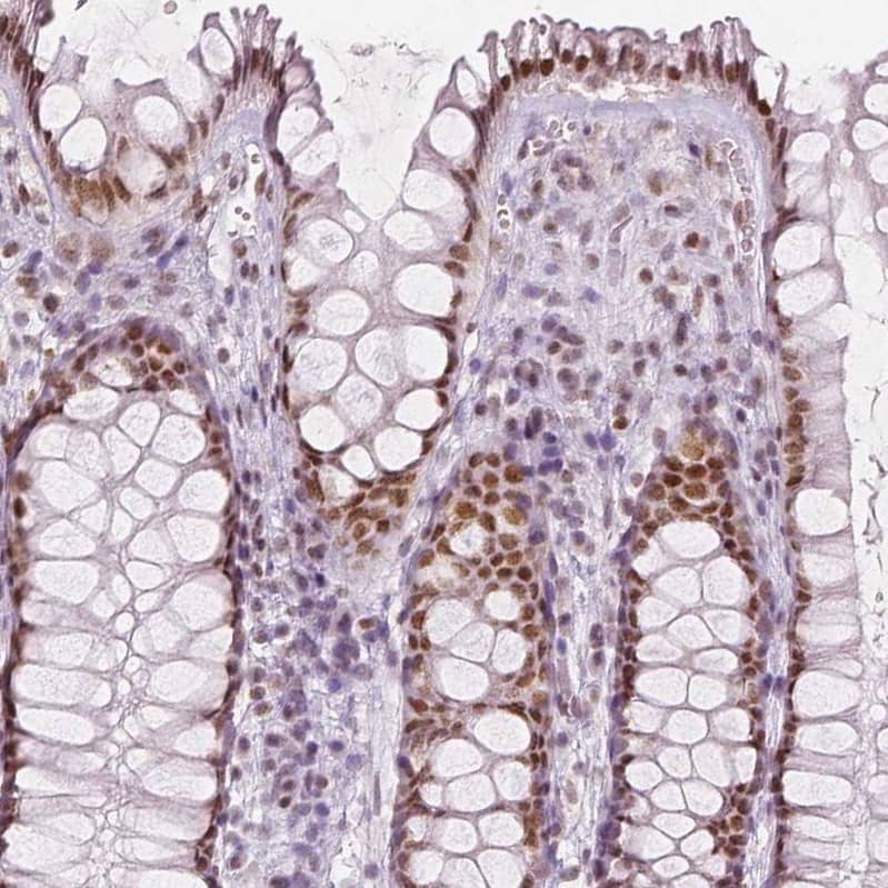 Staining of human rectum shows moderate nuclear positivity in glandular cells.